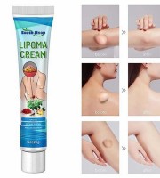 Lipoma Removal Cream-লাইপোমা রিমুভাল ক্রিম