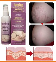 Ignite Mother Care Lotion