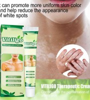 Sumifun Vitiligo Care Cream