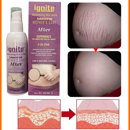 Ignite Mother Care Lotion